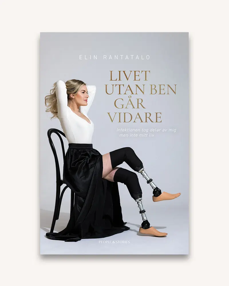 Livet utan ben går vidare – Infektionen tog delar av mig men inte mitt liv