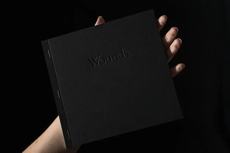 Wounds